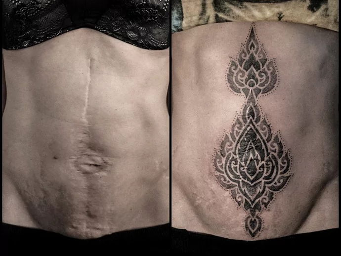 Tattoos For Hiding Scars Scar Camouflage  Body Art Guru